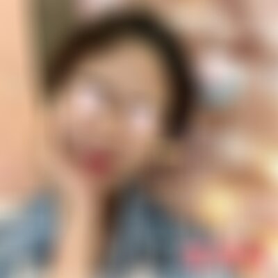 成都军建医院治痘坑怎么样