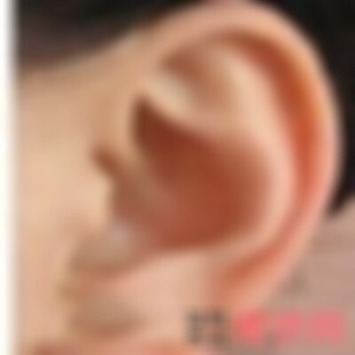 北京丽都医院做畸形耳怎么样
