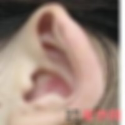 北京丽都医院做畸形耳怎么样