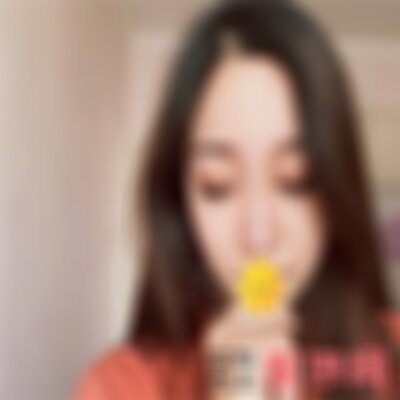 保定华美自体太阳穴填充效果如何