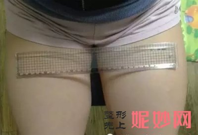 四川娇点吸脂怎么样