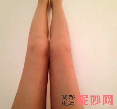 四川娇点吸脂怎么样