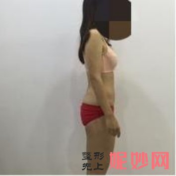 常州美莱医疗冰点脱毛怎么样