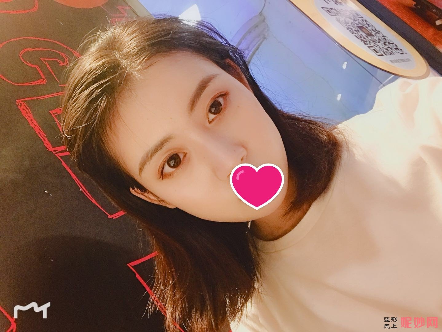 西京医院整形科打瘦脸*多少钱