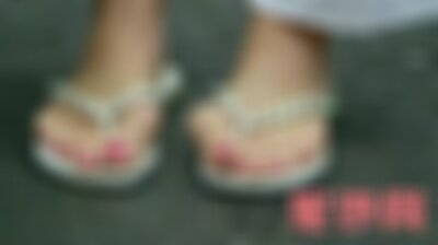 北京中日友好医院整形外科医院袪大脚骨怎么样