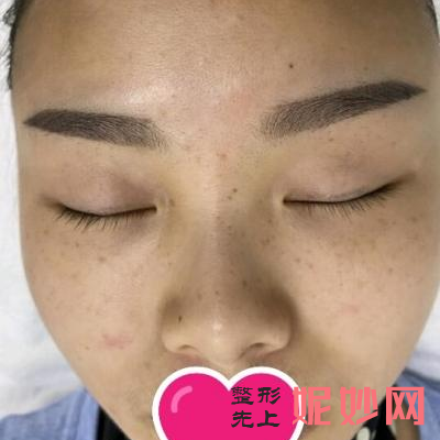 四川娇点医院做皮秒怎么样