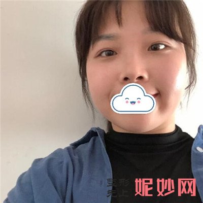 北京华韩医院皮秒消斑怎么样