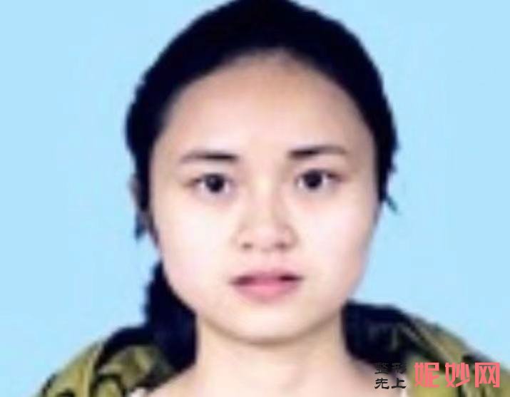 王晓霞正颌手术案例_王晓霞正颌技术怎么样？