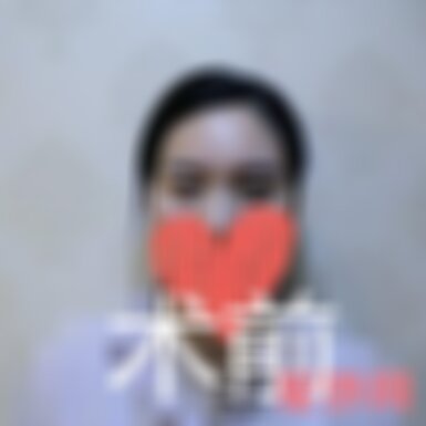 湖南省人民医院李波割双眼皮案例