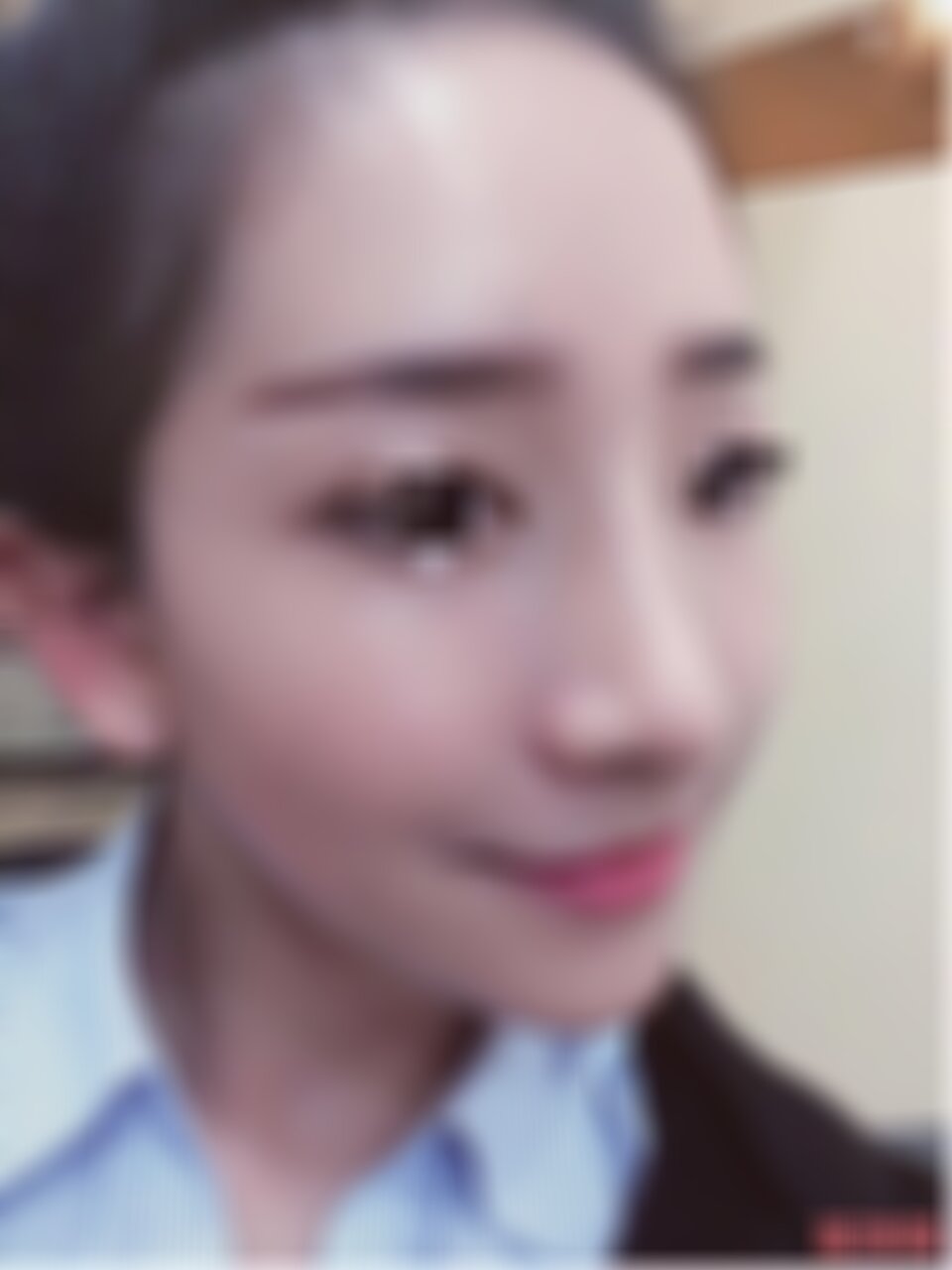 华西医院整形隆鼻手术怎么样