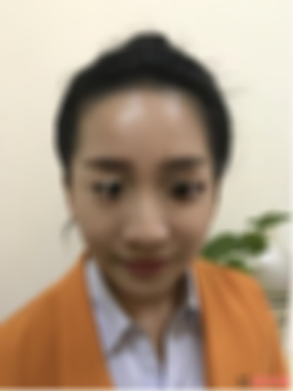 华西医院整形隆鼻手术怎么样