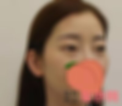 北京薇琳医疗超皮秒祛斑怎么样