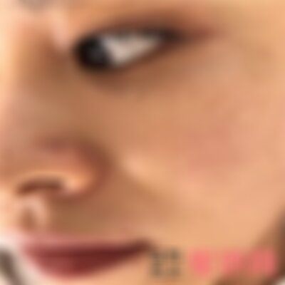 北京丽都医疗美容医院打玻尿酸怎么样