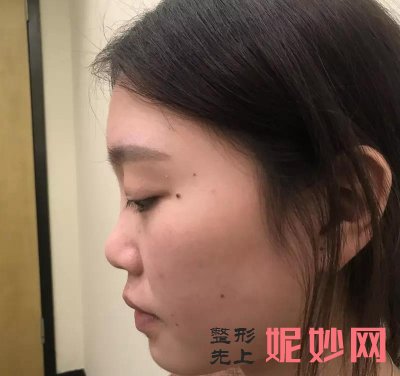 常州美莱医院做全鼻再造吗
