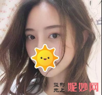 常州美莱医院做全鼻再造吗