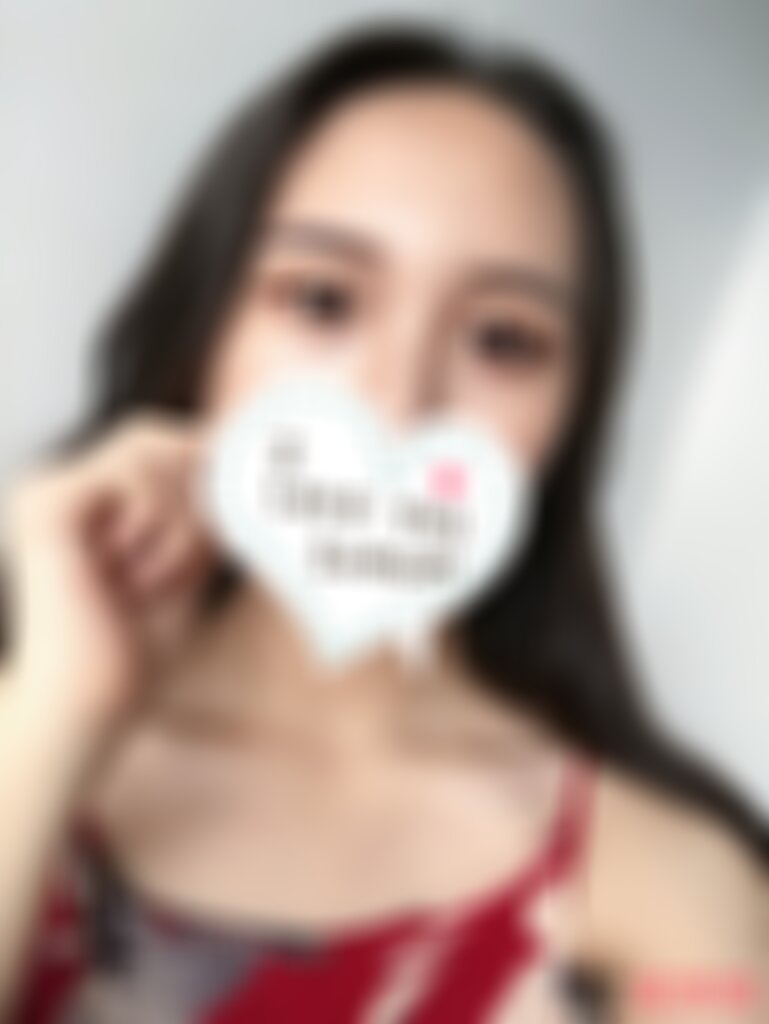 深圳北大医院整形科埋线双眼皮怎么样