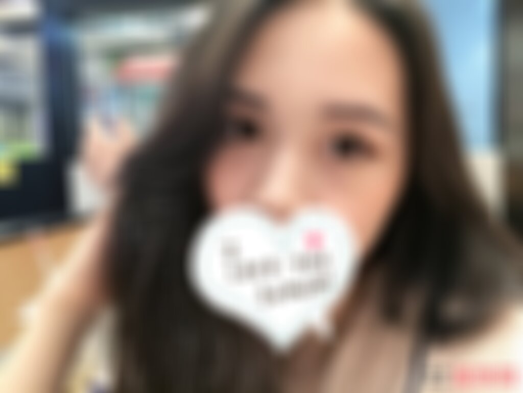 深圳北大医院整形科埋线双眼皮怎么样