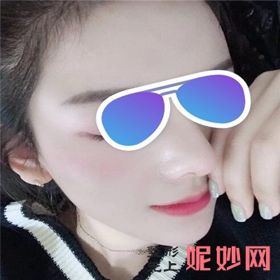 广州曙光医院哪个医生鼻子做得好