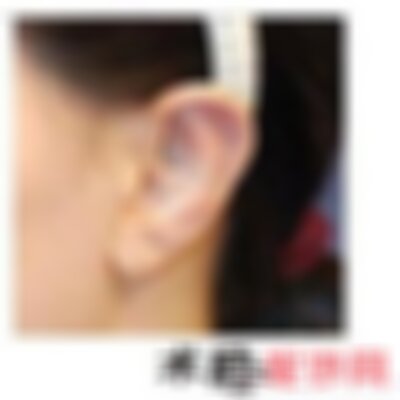 北京丽都做小耳整形怎么样