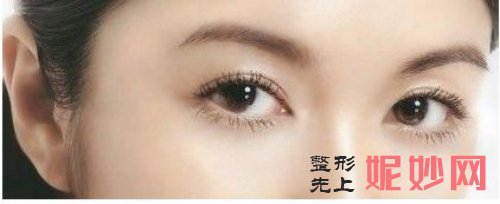 广州曙光做眼皮提升大概需要多少钱
