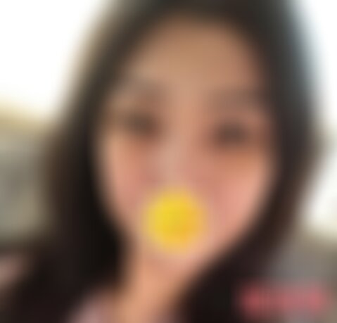 四川米兰柏羽做内切眼袋如何