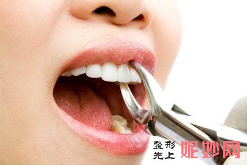 广州曙光口腔拔牙多少钱