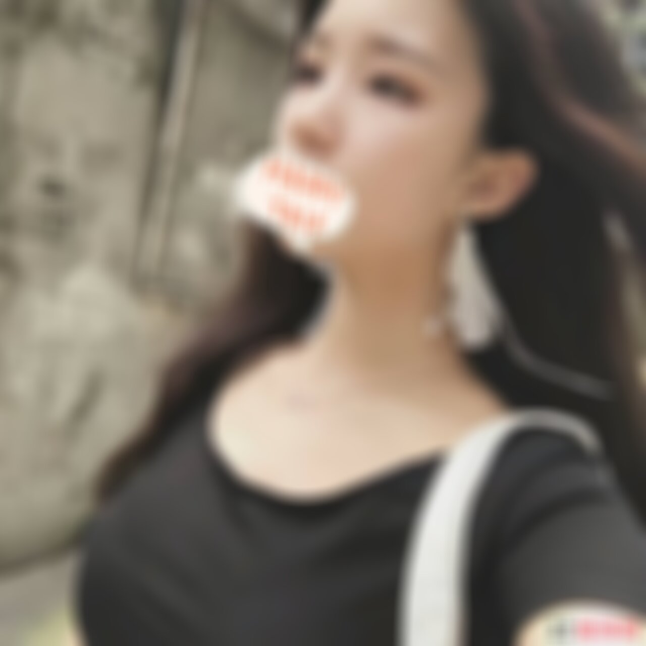 深圳北大医院整形科割双眼皮效果怎么样