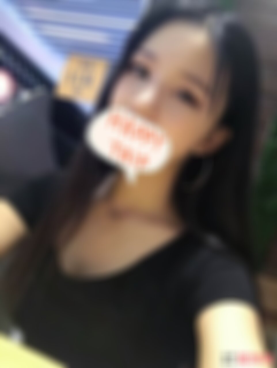 深圳北大医院整形科割双眼皮效果怎么样