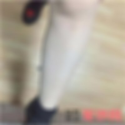 成美整形医院脱毛怎么样