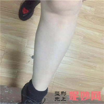 广州曙光整形医院激光脱毛怎么样