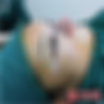 北京丽都整容医院隆鼻怎么样