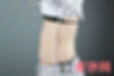 沈阳杏林整形医院燃肚子脂肪好不好