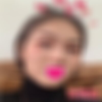 北京丽都美容医院做超声刀怎么样