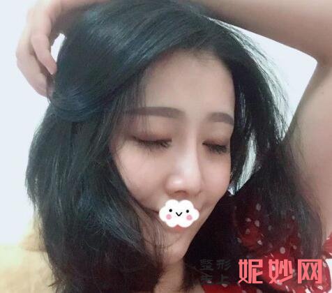 华西医院整形科收费贵吗