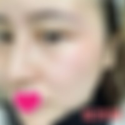 成都军建医院脂肪填充面部怎么样
