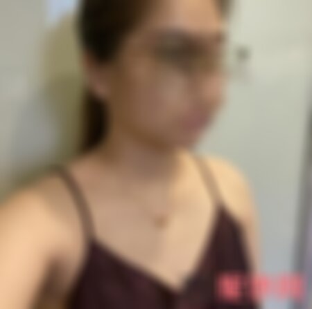 四川美莱丰胸案例