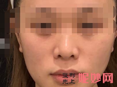 超声炮多少钱一次？超声炮有哪些作用和效果，附案例价格表！