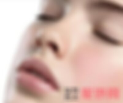 广州曙光医院有激光去痣吗