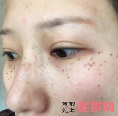 常州美莱医院祛斑有哪些医生
