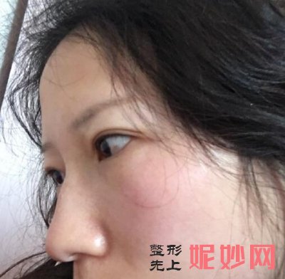 常州美莱医院祛斑有哪些医生