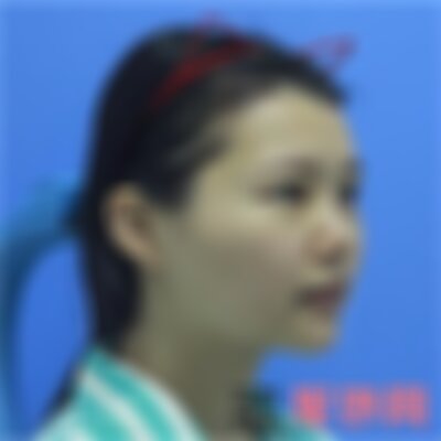 北京华韩面部吸脂怎么样