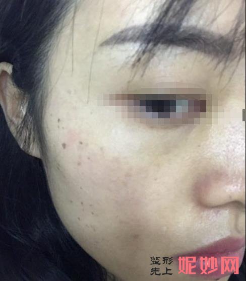 四川华美紫馨美容医院祛斑怎么样