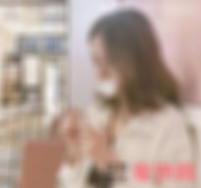 四川米兰柏羽鼻综合案例