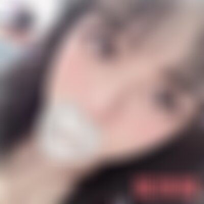 北京丽都医院做双眼皮修复怎么样