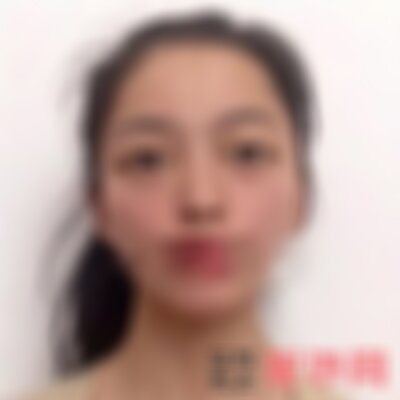 北京华韩韩式双眼皮怎么样