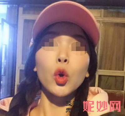 四川娇点医学美容医院有脂肪填充吗