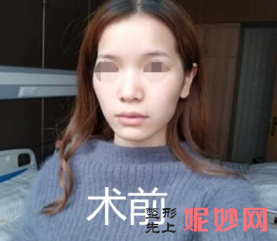 四川娇点医学美容医院有脂肪填充吗