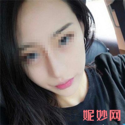 广州曙光医院做下颌角吗