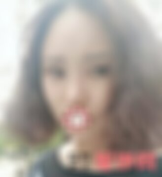 四川悦好整形医院双眼皮手术怎么样