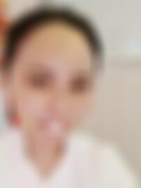 四川悦好整形医院双眼皮手术怎么样